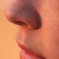 crvenilo.png